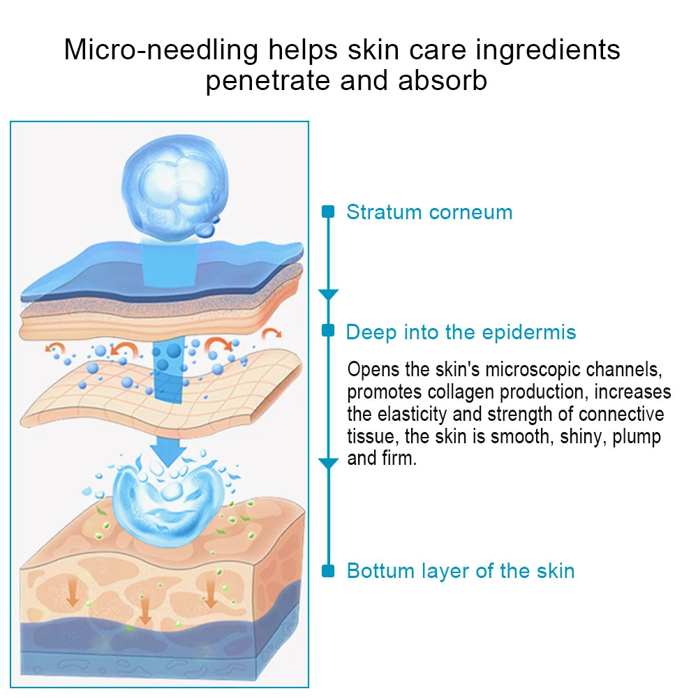 RevivalMICRONeedle - Professional Dermaroller